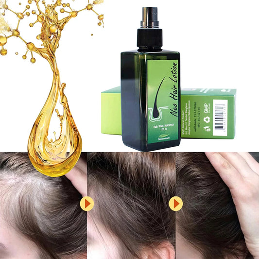 Orginal Natural Thailand Neo Hair Lotion Hair Care Oil Hair Grow