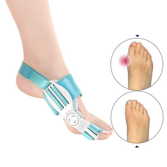 Advanced hallux valgus bunion aid splint - FeetiFix